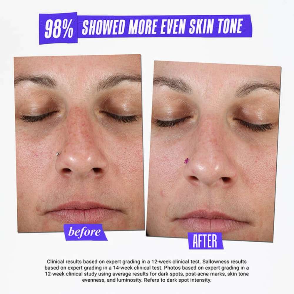 Kiehl's Since 1851 Clearly Corrective™ Dark Spot Solution