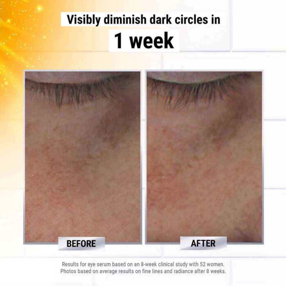 Kiehl’s Since 1851 Powerful-Strength Dark Circle Reducing Vitamin C Eye Serum