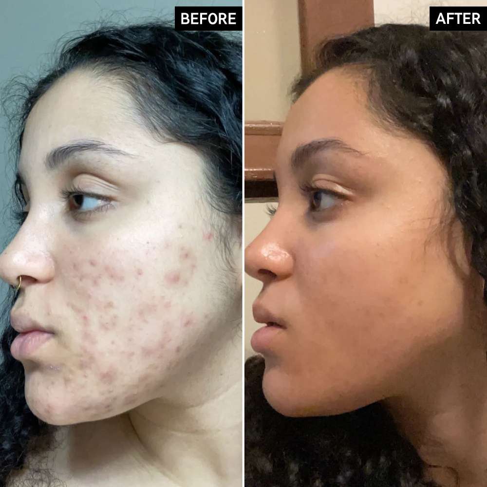 The INKEY List Vitamin C Serum 30% L-Ascorbic Acid
