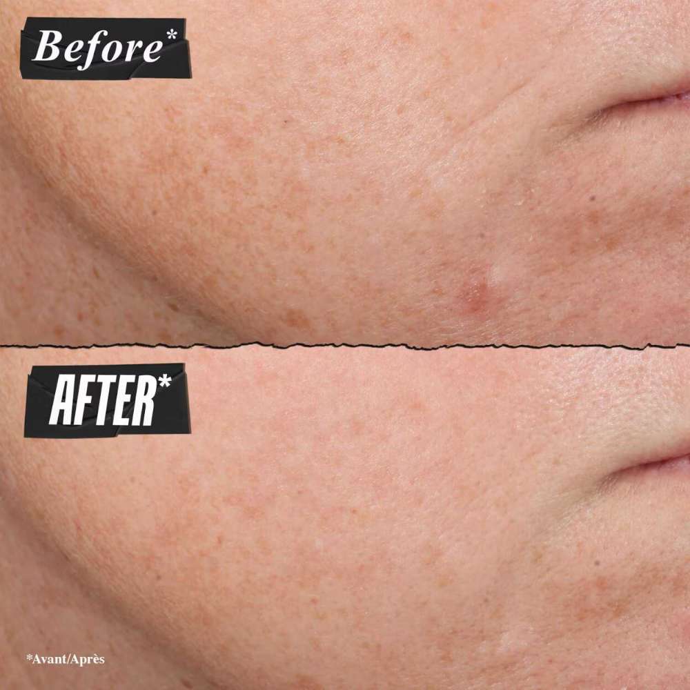 Kiehl's Since 1851 Retinol Skin-Renewing Daily Micro-Dose Serum