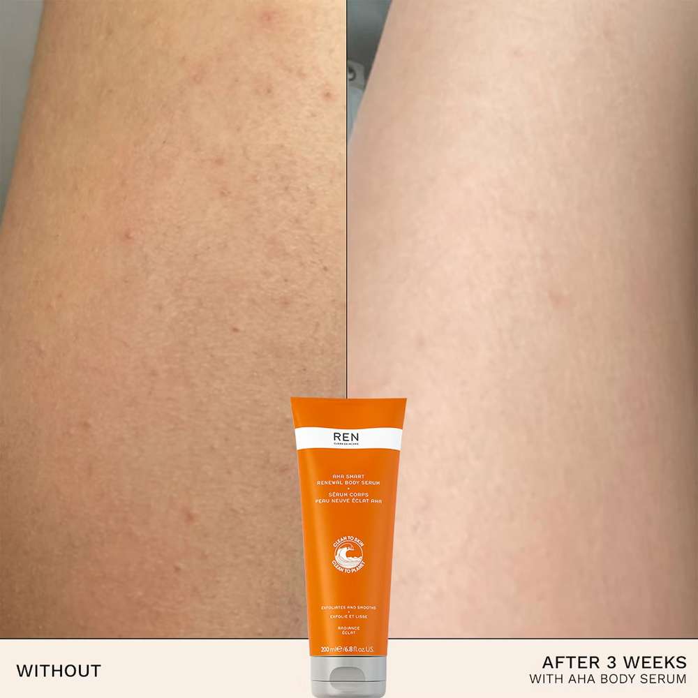 REN Clean Skincare AHA Smart Renewal Body Serum