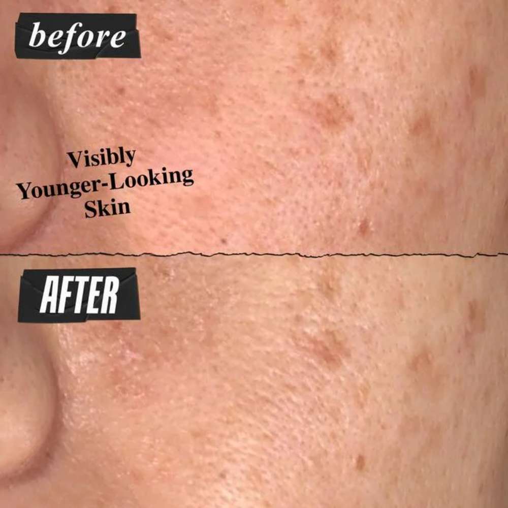 Kiehl’s Since 1851 Super Multi-Corrective Anti-Aging Cream for Face & Neck