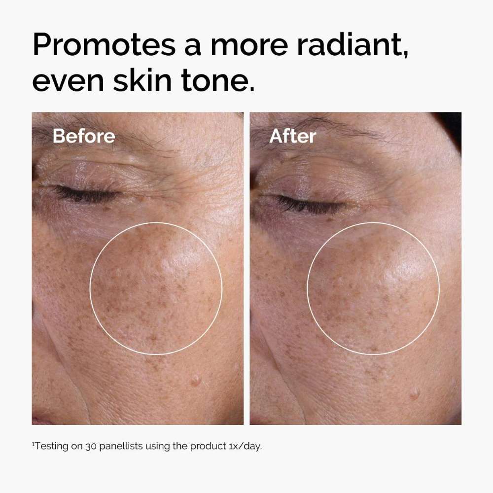 The Ordinary Glycolic Acid 7% Exfoliating & Brightening Daily Toner