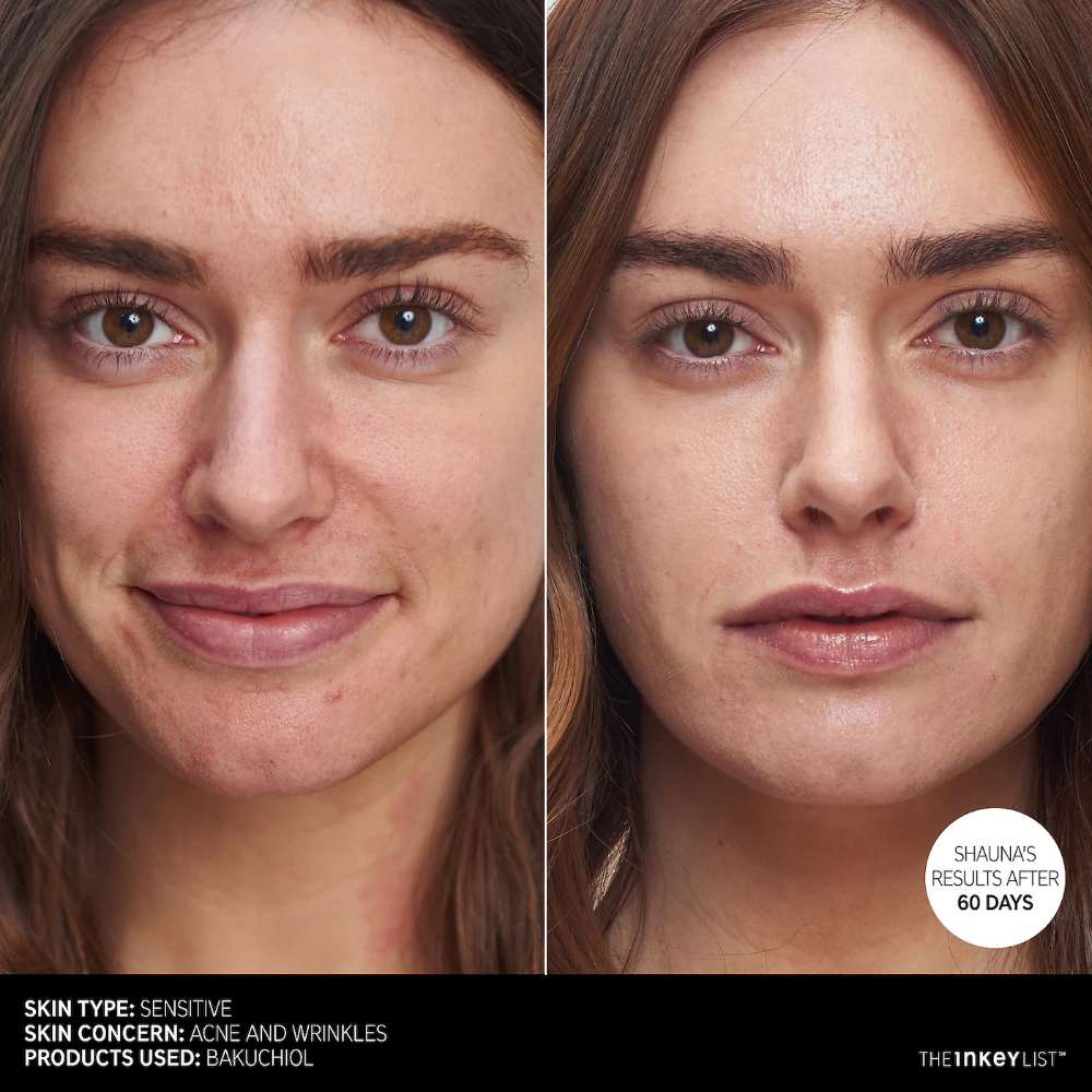 The INKEY List Bakuchiol Retinol Alternative Moisturizer