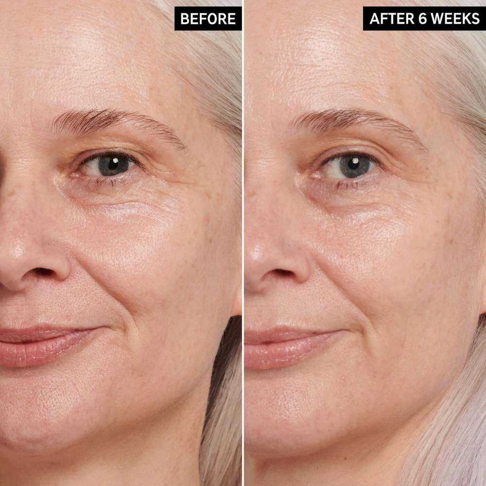 The INKEY List Retinol Eye Cream