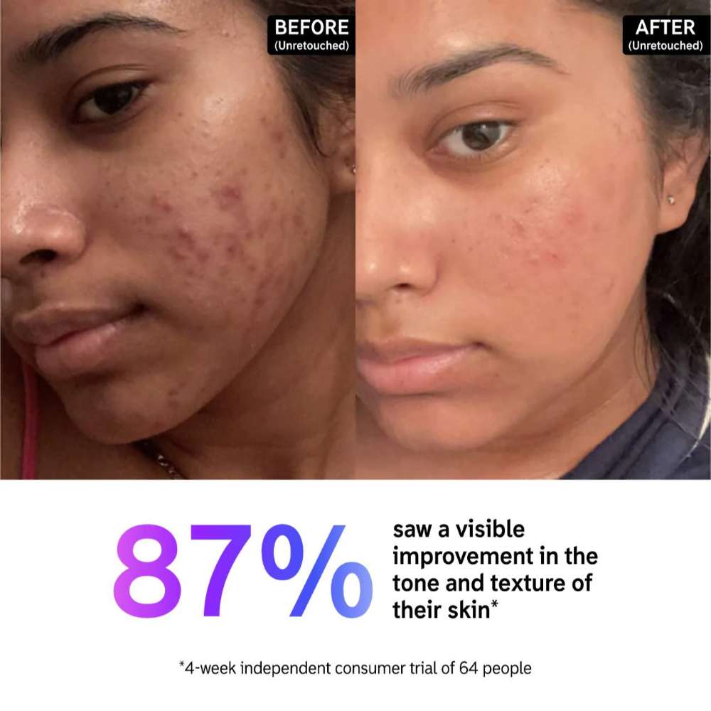 The INKEY List 15% Vitamin C & EGF Brightening Serum