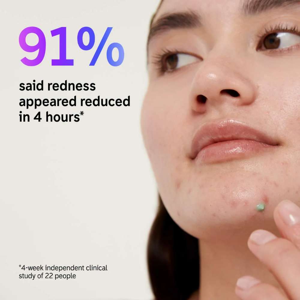 The INKEY List Succinic Acid Acne Treatment