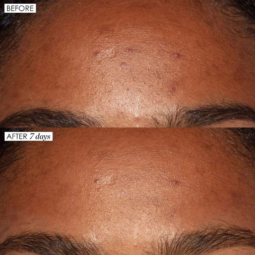 Sunday Riley Good Genes All-In-One AHA Lactic Acid Treatment