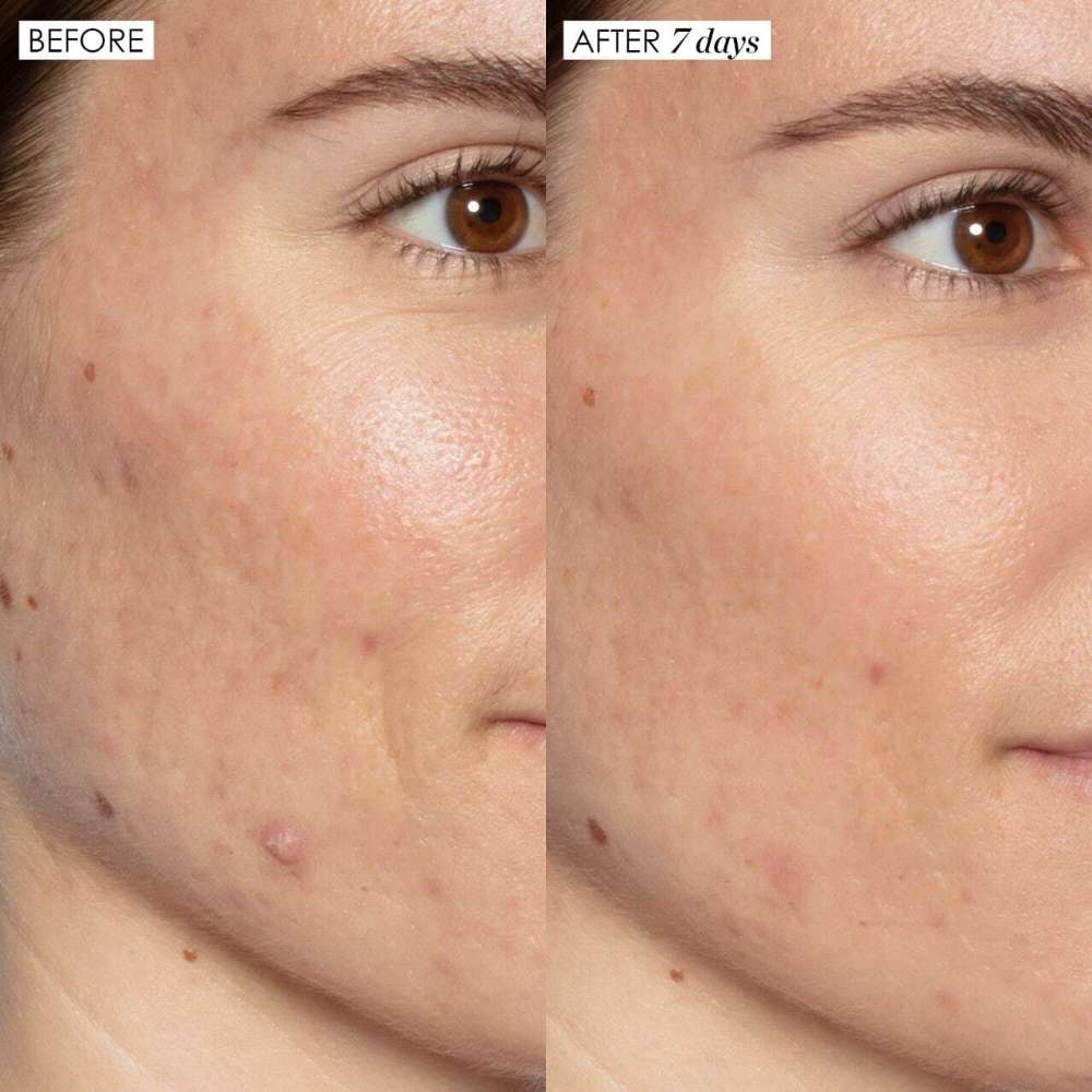 Sunday Riley Good Genes All-In-One AHA Lactic Acid Treatment