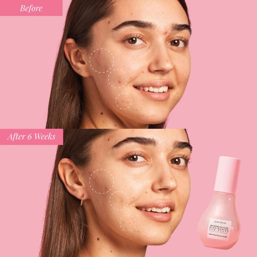 Glow Recipe Watermelon Glow Niacinamide Dew Drops Serum