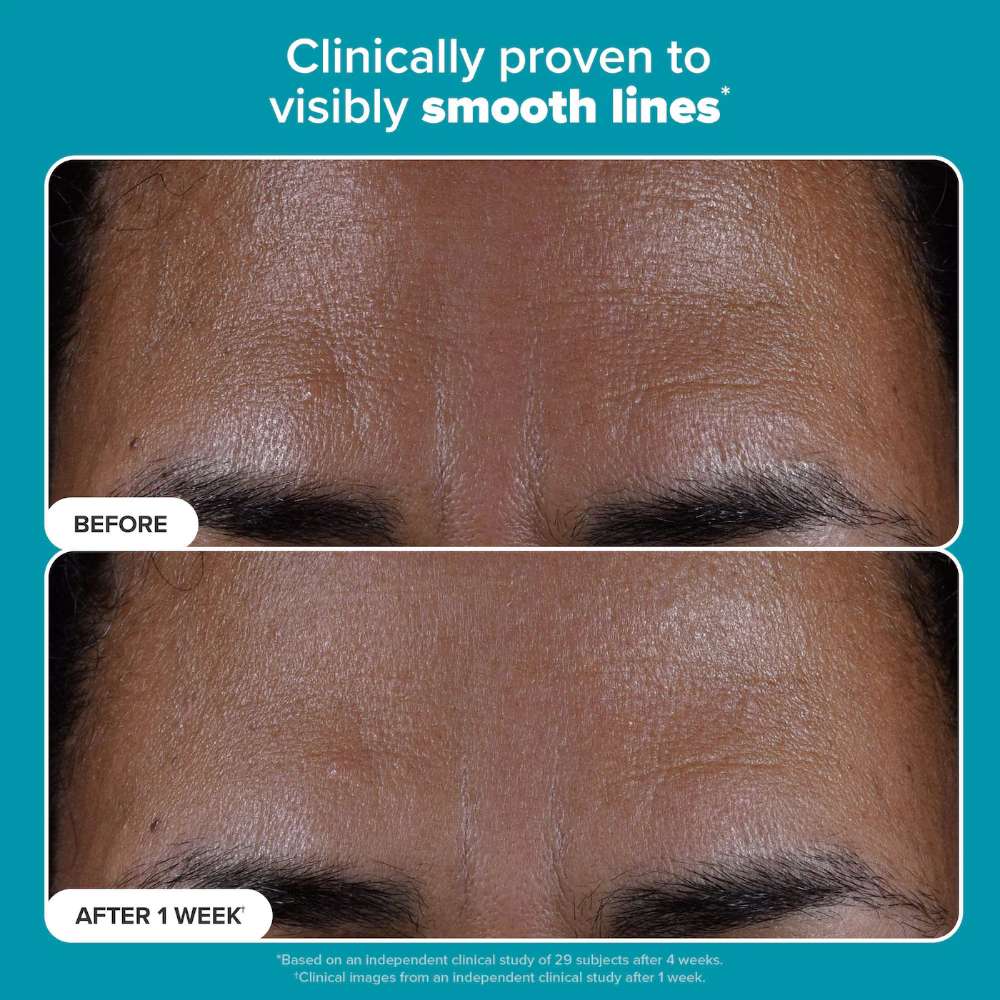 Paula's Choice Skin Perfecting 2% BHA Liquid Exfoliant