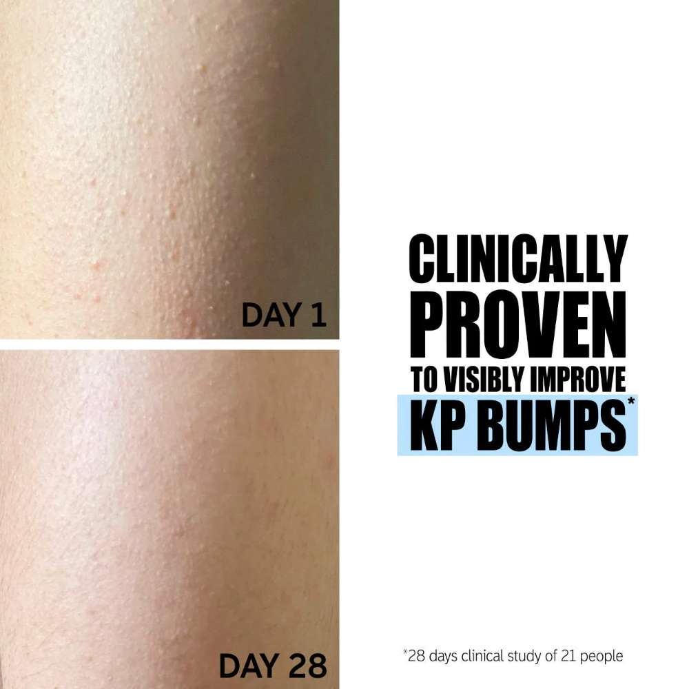The INKEY List Glycolic Acid Exfoliating Body Stick