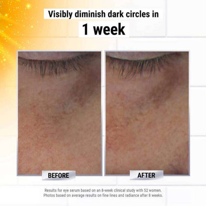 Kiehl’s Since 1851 Powerful-Strength Dark Circle Reducing Vitamin C Eye Serum
