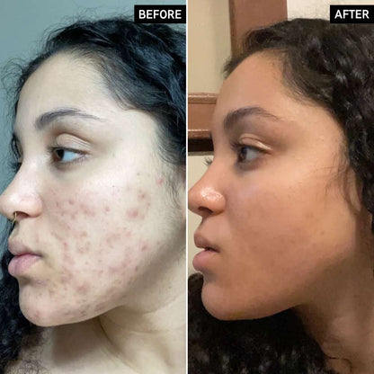 The INKEY List Vitamin C Serum 30% L-Ascorbic Acid