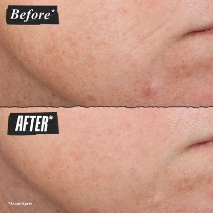 Kiehl's Since 1851 Retinol Skin-Renewing Daily Micro-Dose Serum