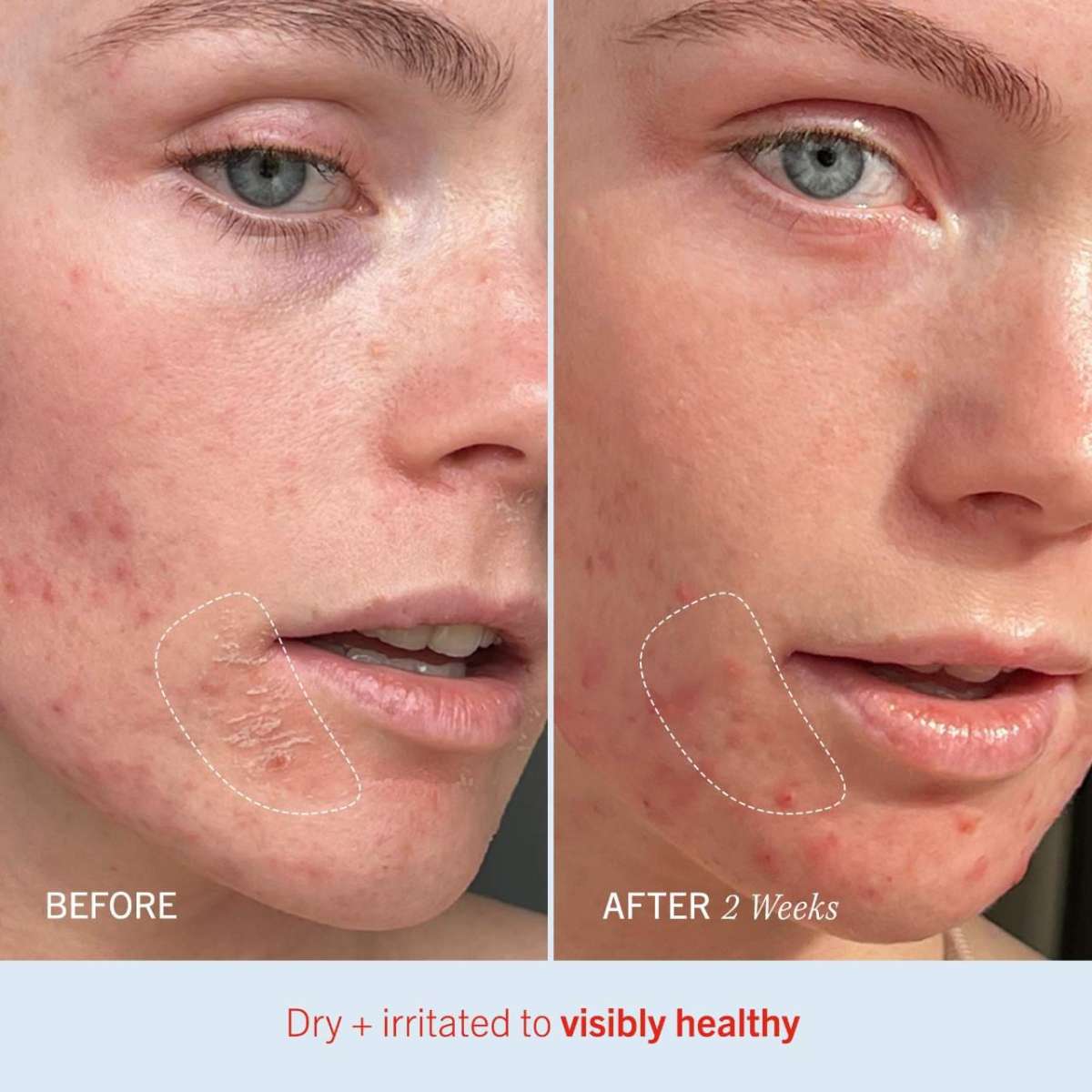 First Aid Beauty Ultra Repair® Cream Intense Hydration
