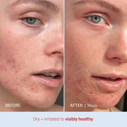First Aid Beauty Ultra Repair® Cream Intense Hydration