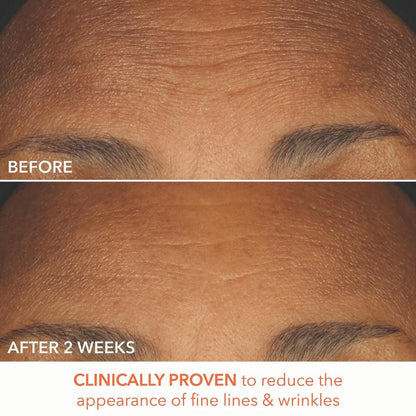 Dr. Dennis Gross Alpha Beta® Extra Strength Daily Peel Pads
