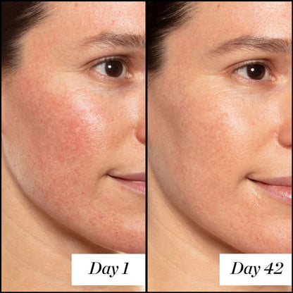 Before and after comparison of a person's face with visible skin improvement over 42 days.