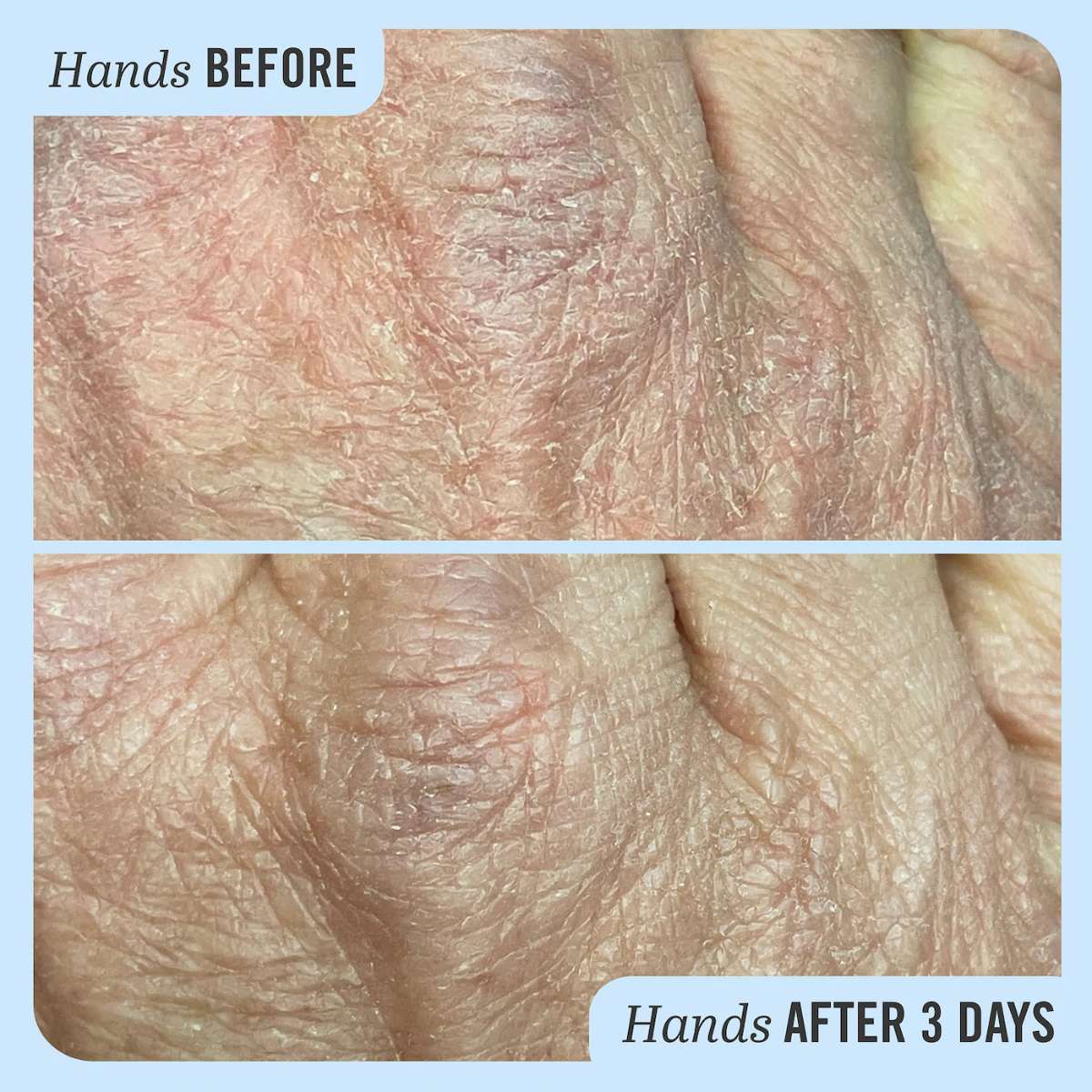 First Aid Beauty Ultra Repair® Cream Intense Hydration