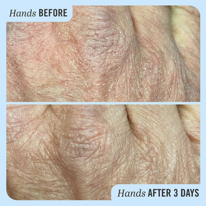 First Aid Beauty Ultra Repair® Cream Intense Hydration