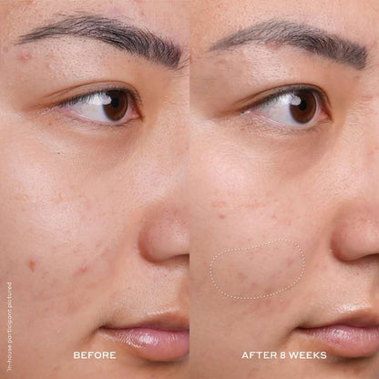 OLEHENRIKSEN Banana Bright 15% Vitamin C Dark Spot Serum