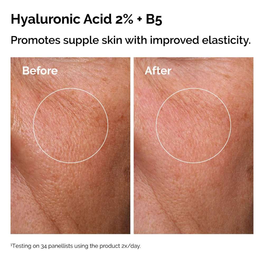 The Ordinary The Skin Support Set