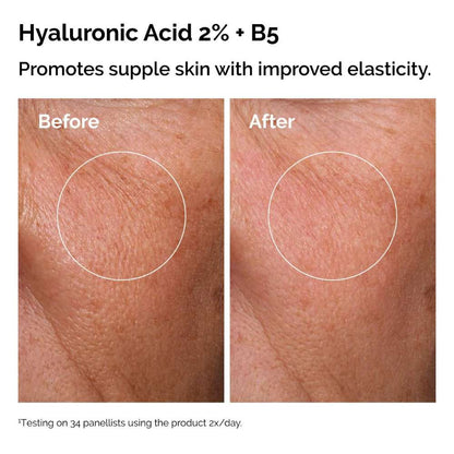 The Ordinary The Skin Support Set